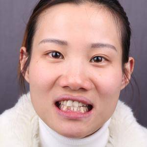 时代天使隐形矫正
