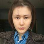 自体脂肪面填