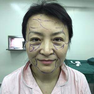 北京炫美抗衰逆龄提升定制
