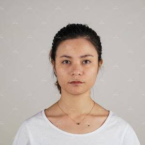 重庆隆鼻 美莱隆鼻