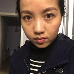 重庆紧肤 美莱射频紧肤