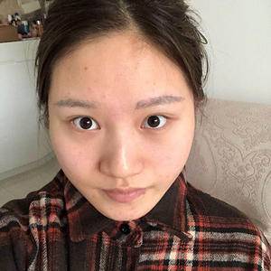 万家燕医院面部吸脂
