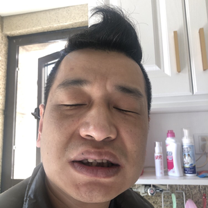 种植牙第一天