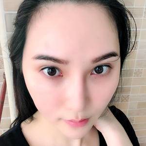 发际线种植让我告别秃头公主