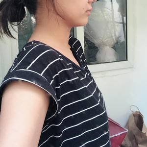 我的隆胸日记