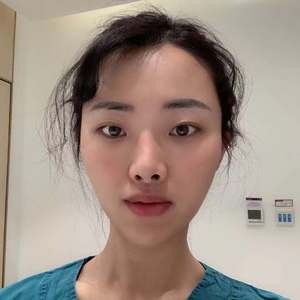 我的隆鼻日记
