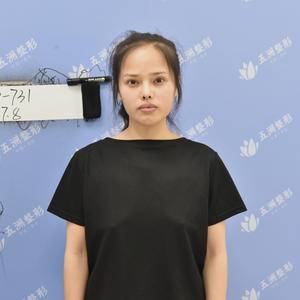 假体隆胸术